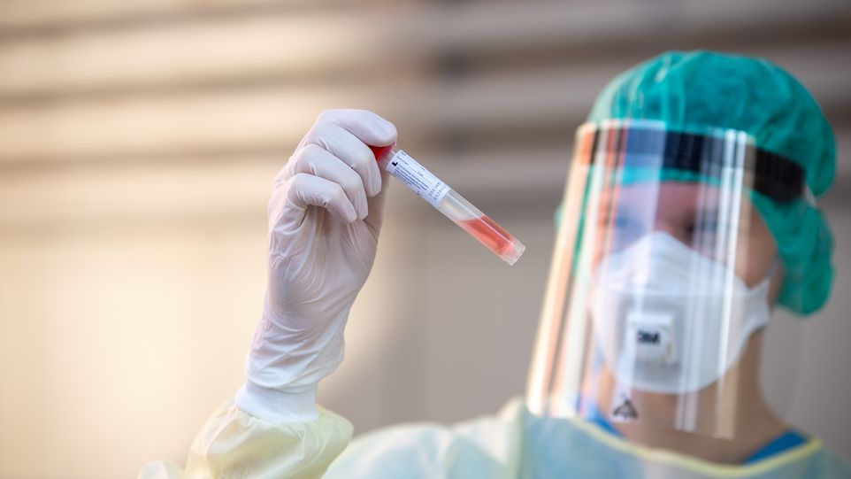 Forscher in Schutzkleidung betrachtet Blutprobe
