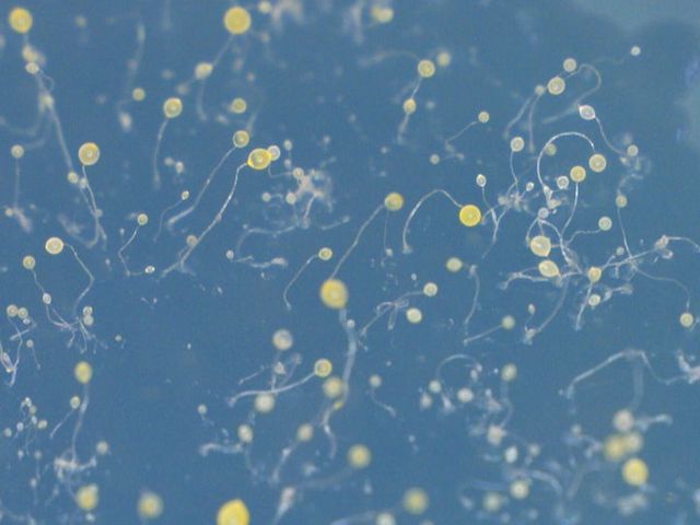 Microscopic image of the fruiting bodies of D. discoideum on an agar plate