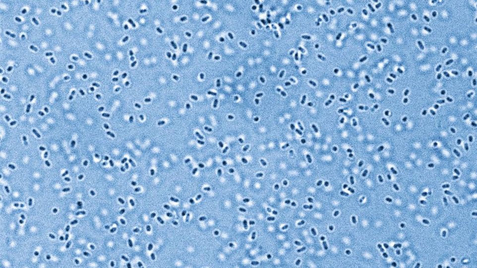 Blau eingefärbte elektronenmikroskopische Aufnahme von Pandoraea sputorum