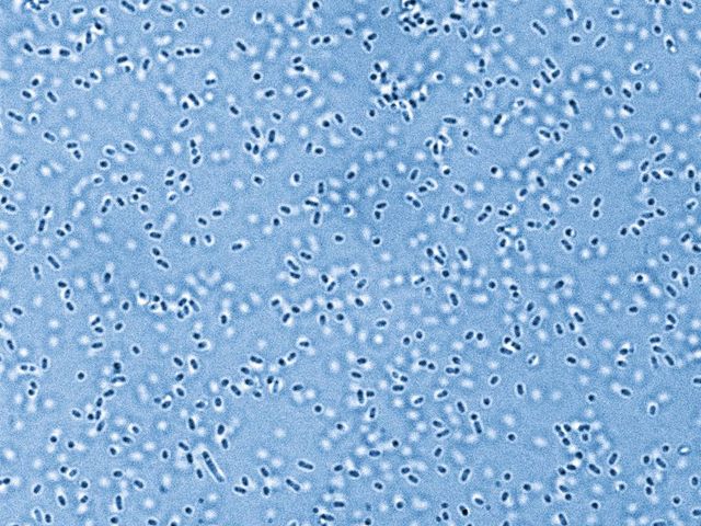 Blau eingefärbte elektronenmikroskopische Aufnahme von Pandoraea sputorum