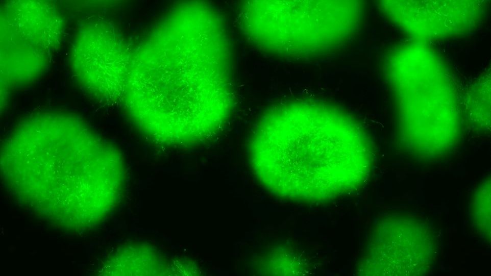 Grüne Flecken auf schwarzem Hintergrund: Der Schimmelpilz Aspergillus nidulans produziert ein grün fluoreszierendes Protein.