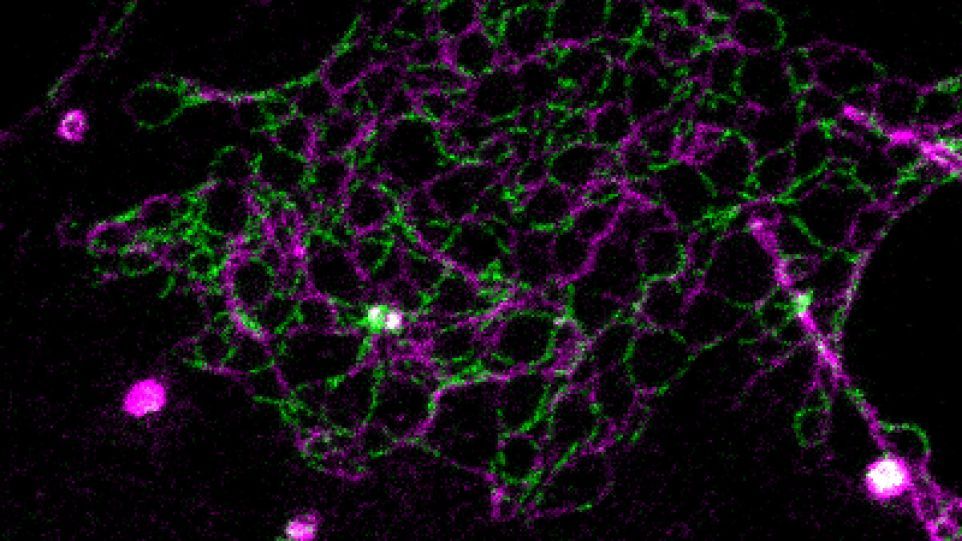 Nano-Netzwerke von segregierenden Claudin 2 (gelb) und Claudin 10 (mangenta) wurden mittels STED Mikroskopie mit 20 nm Pixelgrösse aufgelöst. Nano-Netzwerke