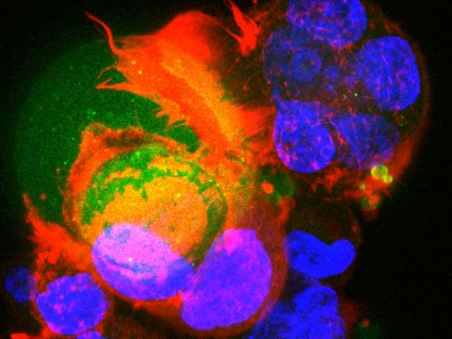 Colour-stained microscope image of a cell culture.