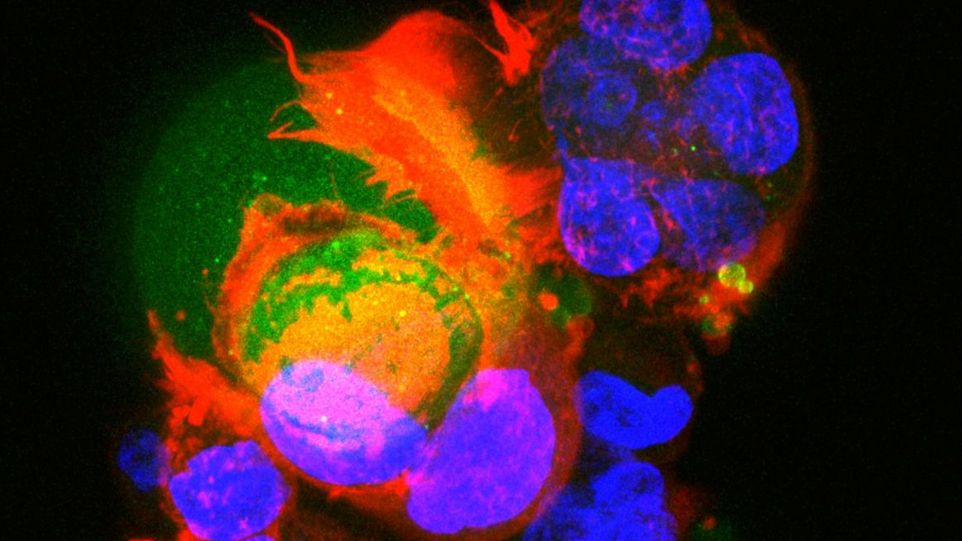 Colour-stained microscope image of a cell culture.