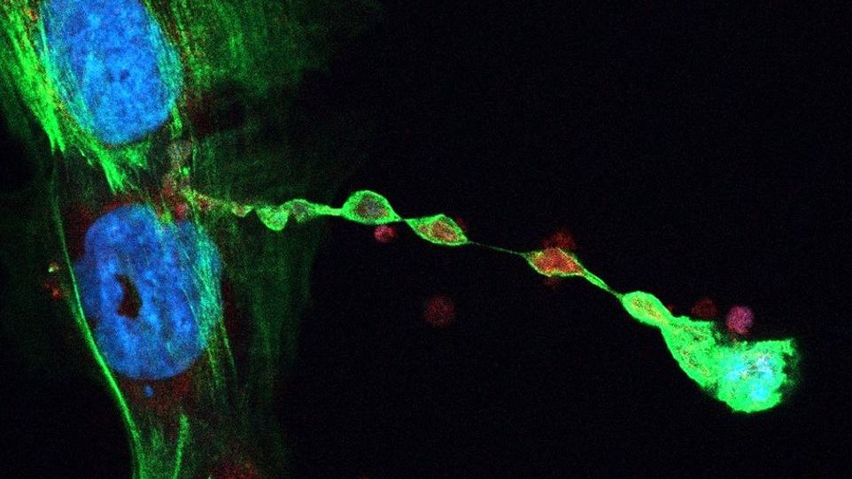 Mitochondria (labelled with red fluorescent dye) migrating from a bone marrow stromal cell to a T cell through the intercellular nanotube. Microscope image of mitochondria in T cells