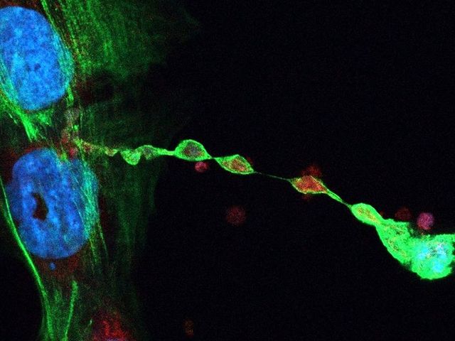 Microscope image of mitochondria in T cells