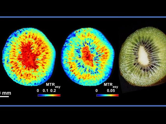 MRI image of a kiwi