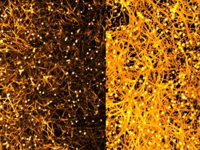 Mikroskopische Aufnahme des Biofilms eines Pilzes