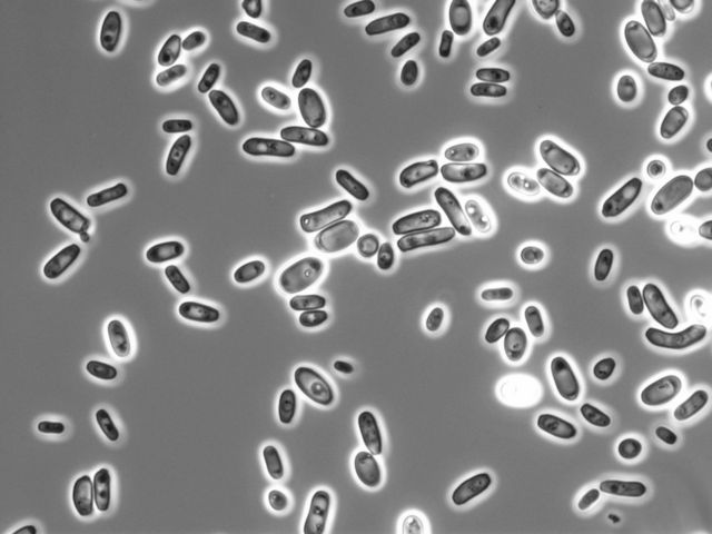 Mikroskopaufnahme von Candida tropicalis Hefezellen