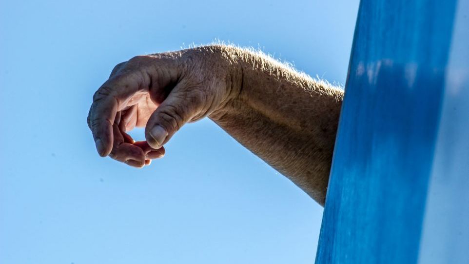Wrinkled arm