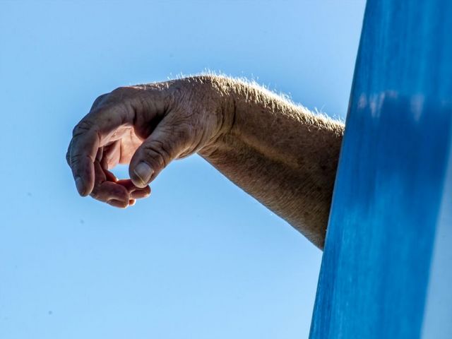Wrinkled arm