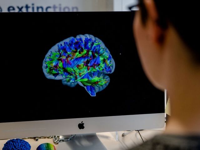 Scientist in front of a computer screen showing brain regions marked in different colors.