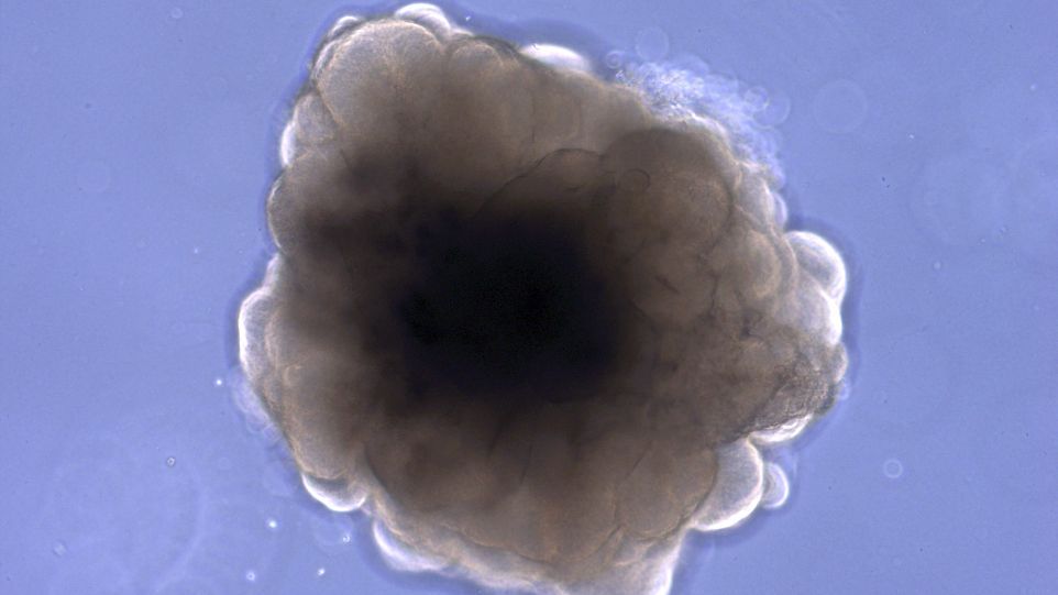 Brain organoid of a rhesus macaque. Brain organoid of a rhesus macaque.