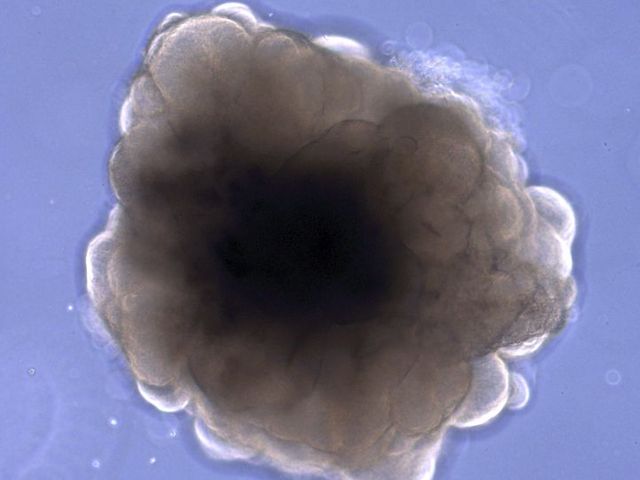 Brain organoid of a rhesus macaque. Brain organoid of a rhesus macaque.