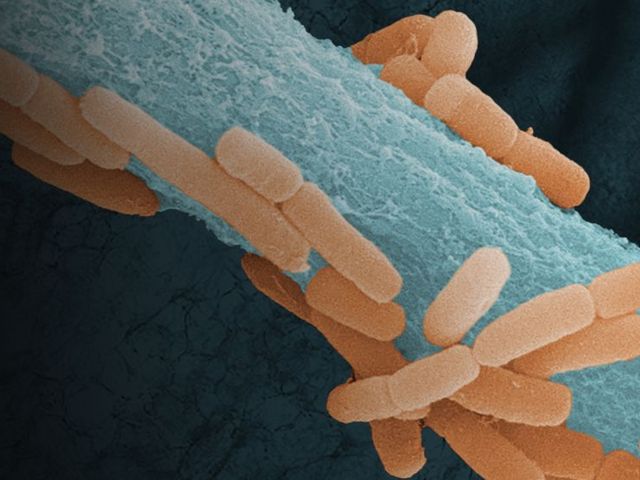 Orange "Stäbchen" des Lungenmikrobioms wuchern auf einem blauen Stamm des Pilzes, Lungengewebe im Hintergrund 
