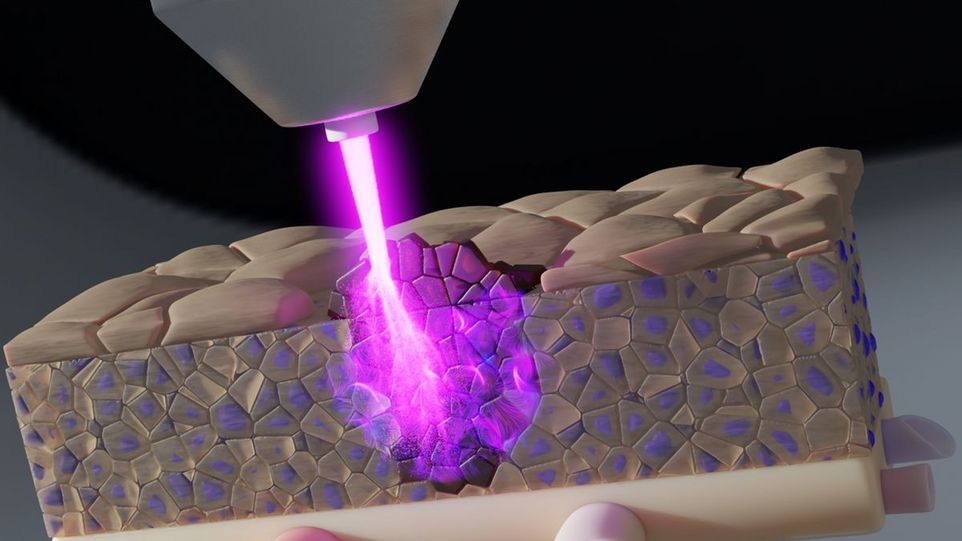 Simulation of a tissue model treated with purple radiation.