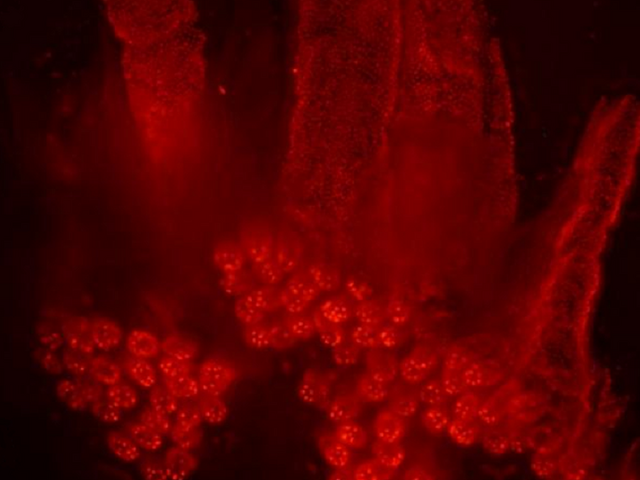 Fluoreszenzmikroskopische Aufnahme von Darmzellen