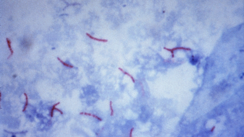 Mycobacterium tuberculosis Red bacteria on a blue background