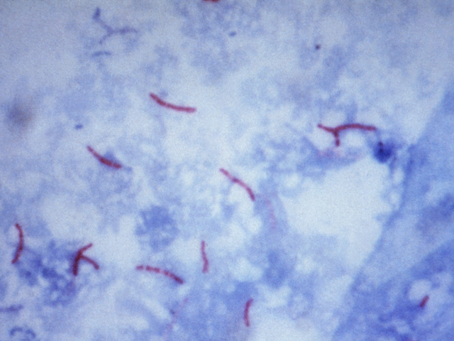Rote Bakterien auf blauem Hintergrund 