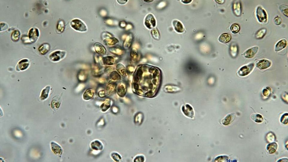 A swarm of prymnesia (from an IGB cell culture) infests an added diatom. The microalgae lyse these in order to absorb the dissolved cell contents. Algae under microscope
