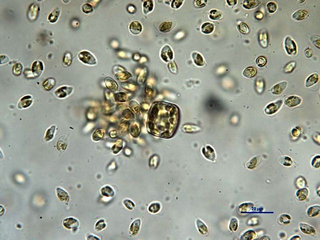 Algae under microscope