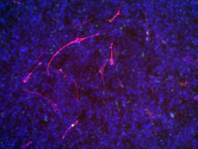 Induction of myogenic differentiation and reduction of cell division in rhabdomyosarcoma cells after reduction of the amount of TRPS1 using siRNA. Blue and red cell structures