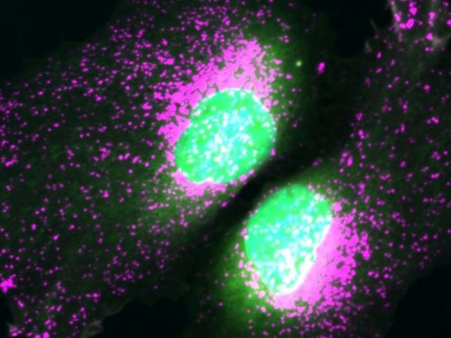 Microscopic image of proteins
