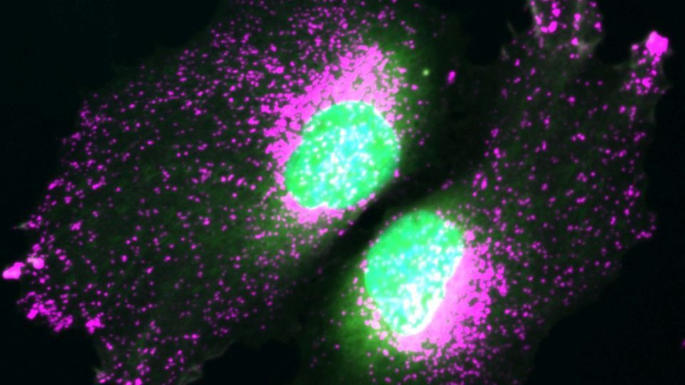 Microscopic image of proteins