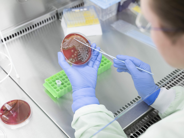 Researcher examines bacteria on a Petri dish