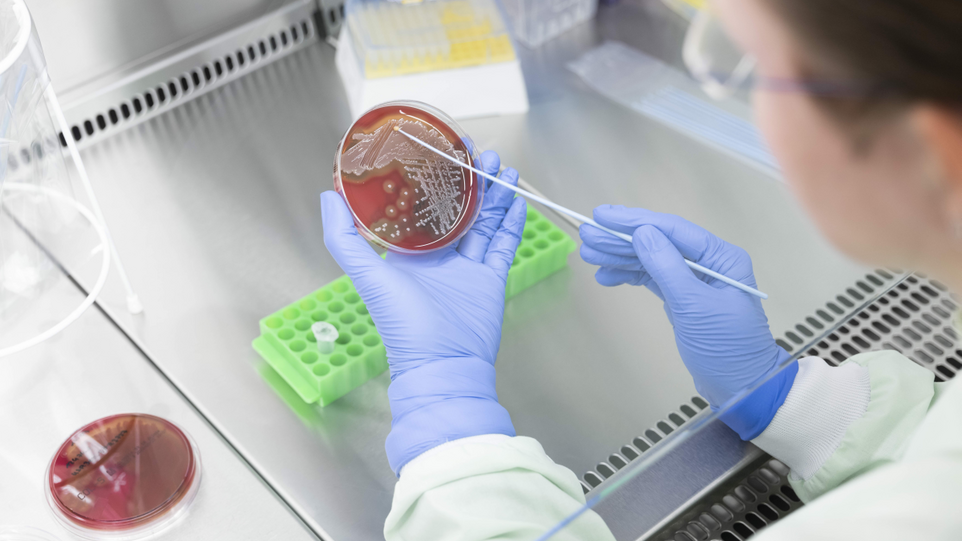 Researcher examines bacteria on a Petri dish