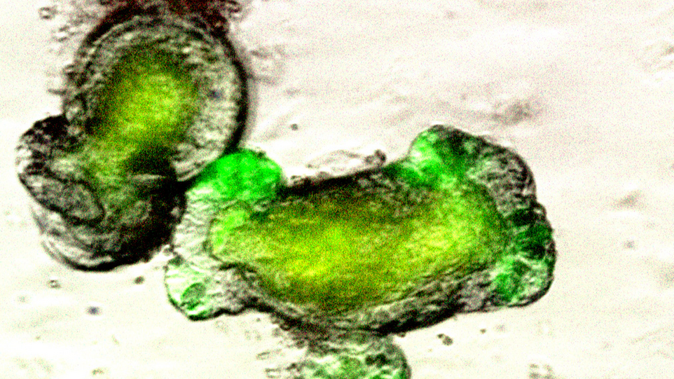Die Wissenschaftler nutzten für ihre Untersuchungen moderne Organoidkulturen, also kleine „Mini-Därme“, die im Labor aus menschlichen Stammzellen gezüchtet werden. Grün gefärbte Organoidkultur