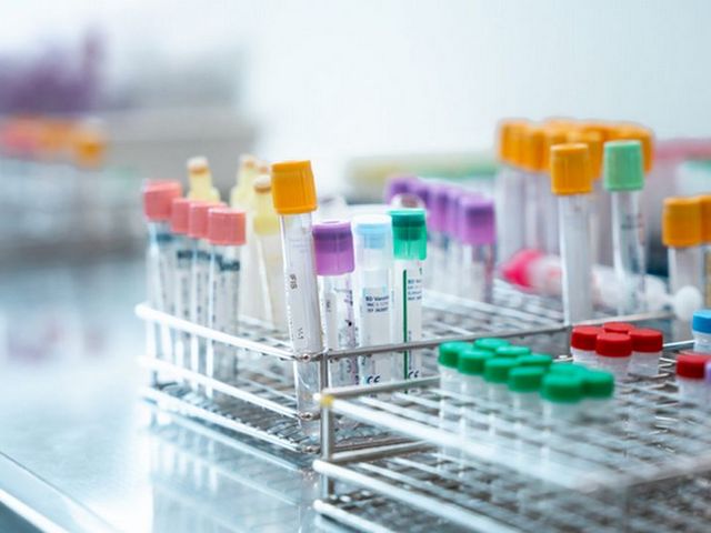Reagenzgläser mit farbigen Verschlüssen
