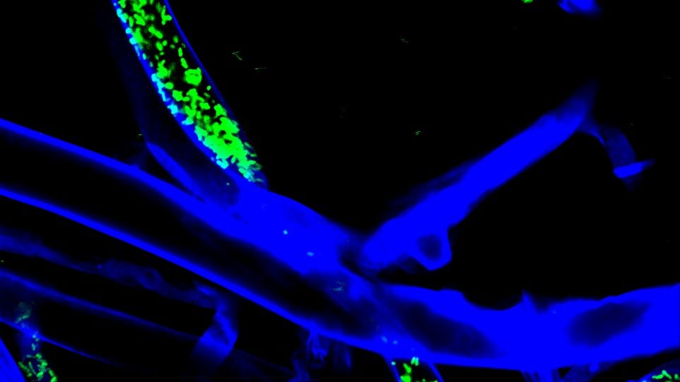Grün und blau fluoriszierende Bakterien und Pilzfäden auf schwarzem Hintergrund.