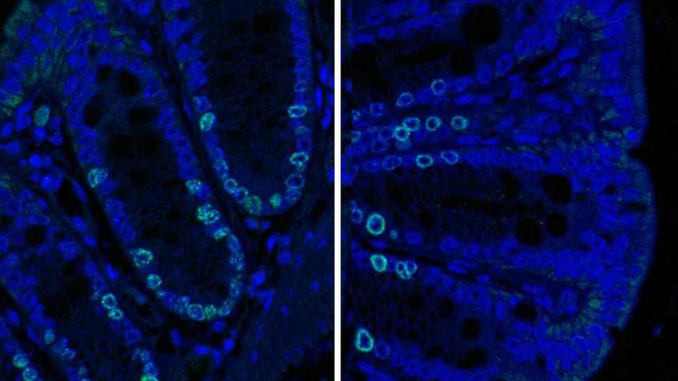 Immunfluoreszenz-Bildgebung des Proliferationsmarkers Ki67 im Dickdarm von gnotobiotischen Wildtyp-Mäusen, welche sekundäre Gallensäuren bilden können (rechts) oder nicht (links). Zwei Mikroskopaufnahmen im Vergleich