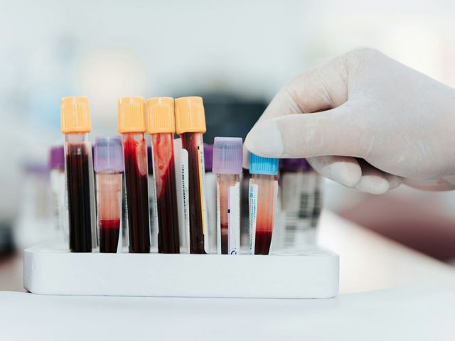 Test tubes with blood