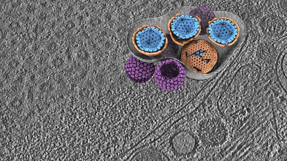 Schnitt durch ein Tomogramm und eine dreidimensionale Darstellung der Austrittskomponenten im Hintergrund. Tomogramm zeigt Austritt eines Herpes-Virus