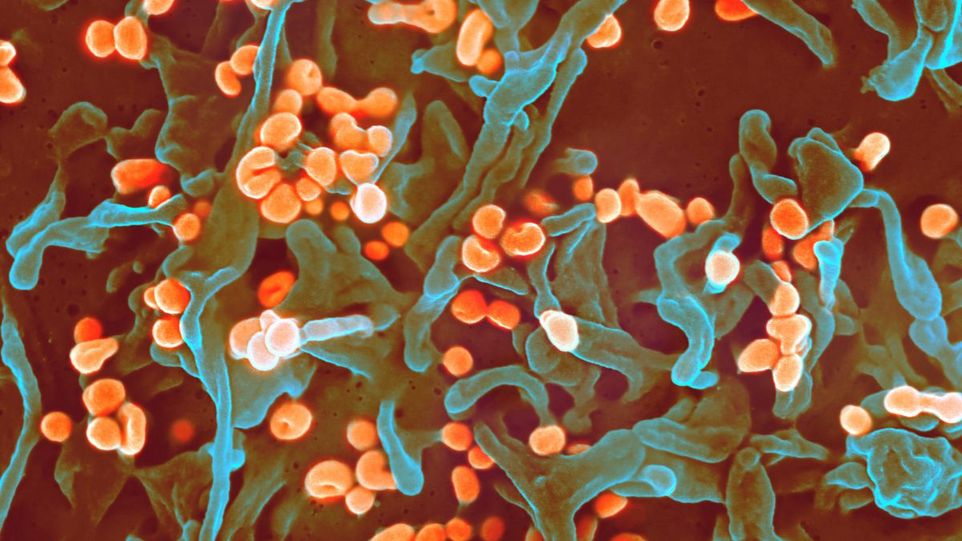 Rasterelektronenmikroskopische Aufnahme des Lassa-Virus, das aus einer Vero-Zelle austritt Mikroskopaufnahme eines Lassa-Virus