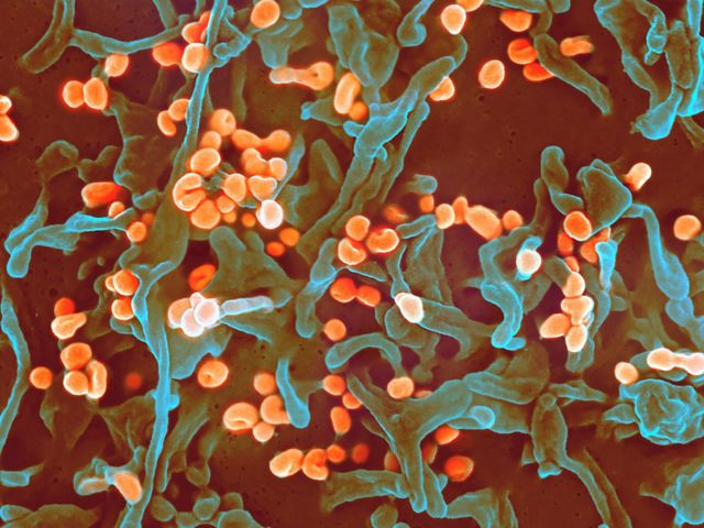 Mikroskopaufnahme eines Lassa-Virus