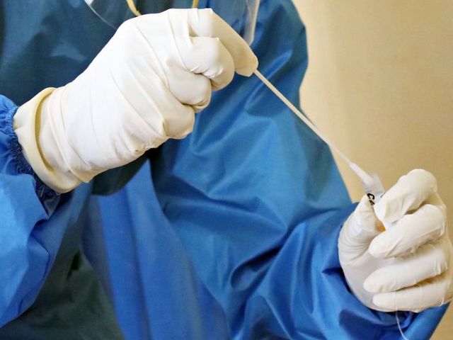 Person in Kittel und Handschuhen hält Wattestäbchen und Probenröhrchen 