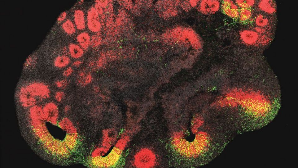 Das ARHGAP11B-Gen führt im Schimpansen-Hirnorganoid zu einer Vermehrung der für das Hirnwachstum relevanten Hirnstammzellen. Hirnorganoid mit angefärbten Hirnstammzellen