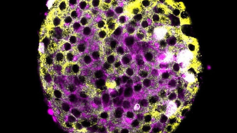 daLUXendins can be visualized using fluorescence microscopy to pinpoint GLP1R and GIPR binding and activation.
