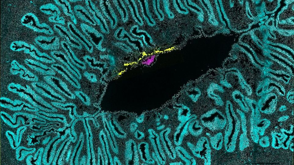 Embryo eines Weißbüschelaffen in der Gebärmutter