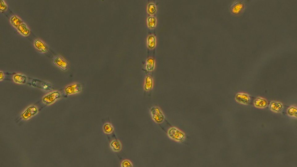 Enfaltete selbst nach rund 7000 Jahren ohne Licht und Luft im Ostseesediment wieder volle Lebensaktivität: Die Kieselalge Skeletonema marinoi. Algen
