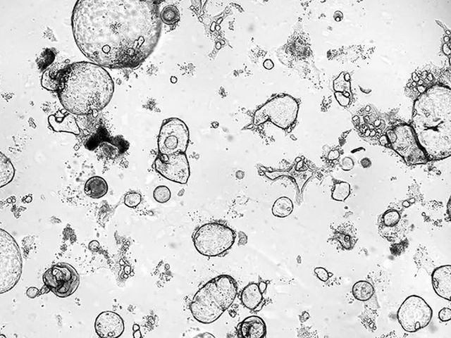 Cells