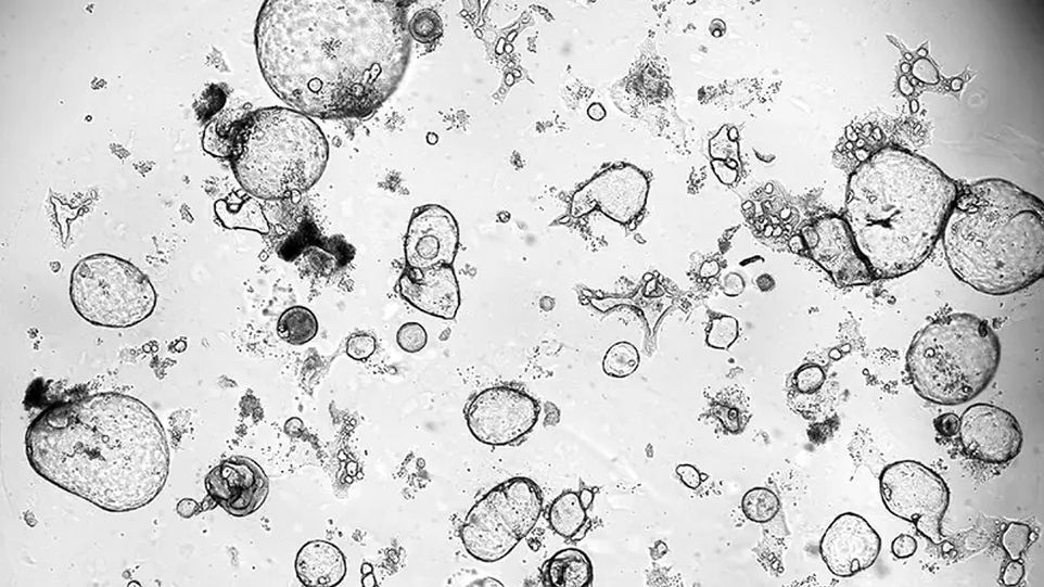 Released factors from activated killer T cells promote the growth of human mini-organs (organoids). Cells